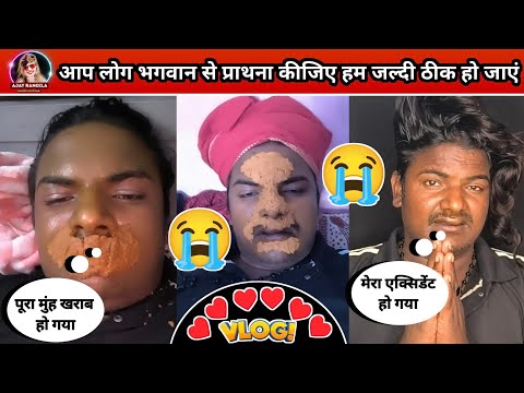 #vlog | Ajay Rangila | आज चोट लगे हुऐ 4 दिन हो गया दोस्तों | 😭😭😭