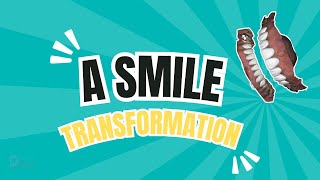 A smile transformation