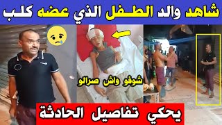 الجزائر شاهد كيف أصبح الطـ ـفل تاج الدين الذي عضه كلـ ـب ووالده يخرج بفيديو يحكي كيف وقعت له الحادثة