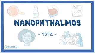 Nanophthalmos (Year of the Zebra 2025)