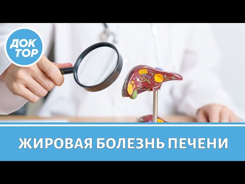 Какие симптомы говорят о заболеваниях печени