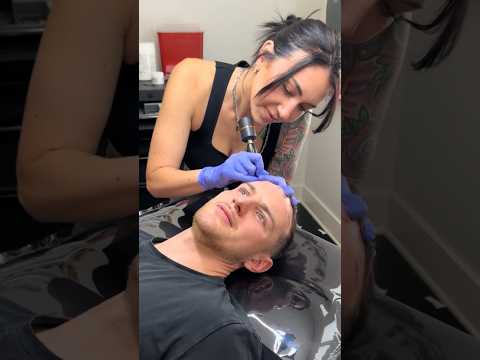 Had to do this #hair #hairline #smp #hairtransformation #hairgrowth #tattoo #hairtransplant