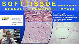 DERMATOPATHOLOGY: Soft Tissue Tumors: Neural Lipomatous Myoid
