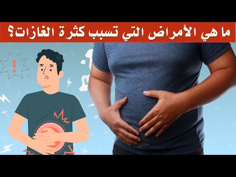 ما هي الأمراض التي تسبب كثرة الغازات؟