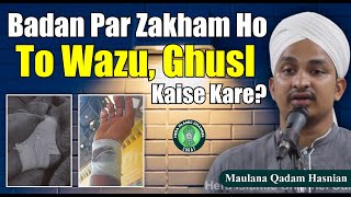 Badan Par Zakham Ho To Wazu Aur Ghusl Kaise Kare? - Maulana Qadam Hasnain 
