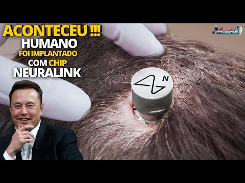 Elon Musk implantou seu chip Neuralink em humano | Optimus aparece no estilo Exterminador do futuro