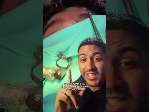 É isso que LATEJA dentro do seu DENTE #shorts #canal