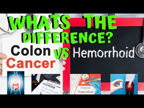 What Are the Differences Between Colon Cancer and...