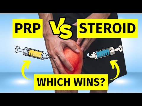 Cortisone Injection vs PRP for Knee Arthritis
