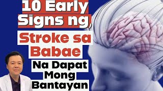 10 Early Signs ng Stroke sa Babae Na Dapat Mong Bantayan.