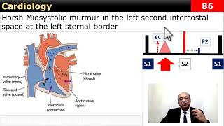 #internal_medicine #cme #usmle #محاضرات_باطنة #ecg #كورسات_باطنة #clinical #clinical #medicine