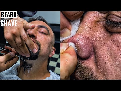 ASMR BEARD CUT AND ACNE REMOVAL • How to cut a shaped beard • Head Massage