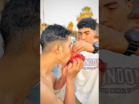 الواد اتعور جامد موت😱😱