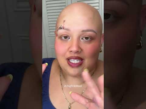 it’s better to be single than w someone who doesn’t love your alopecia/ differences ♥️ #baldiechi
