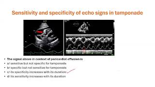 Cardiology MCQs I, Dr Hatim Kheirallah, 6/5/2026