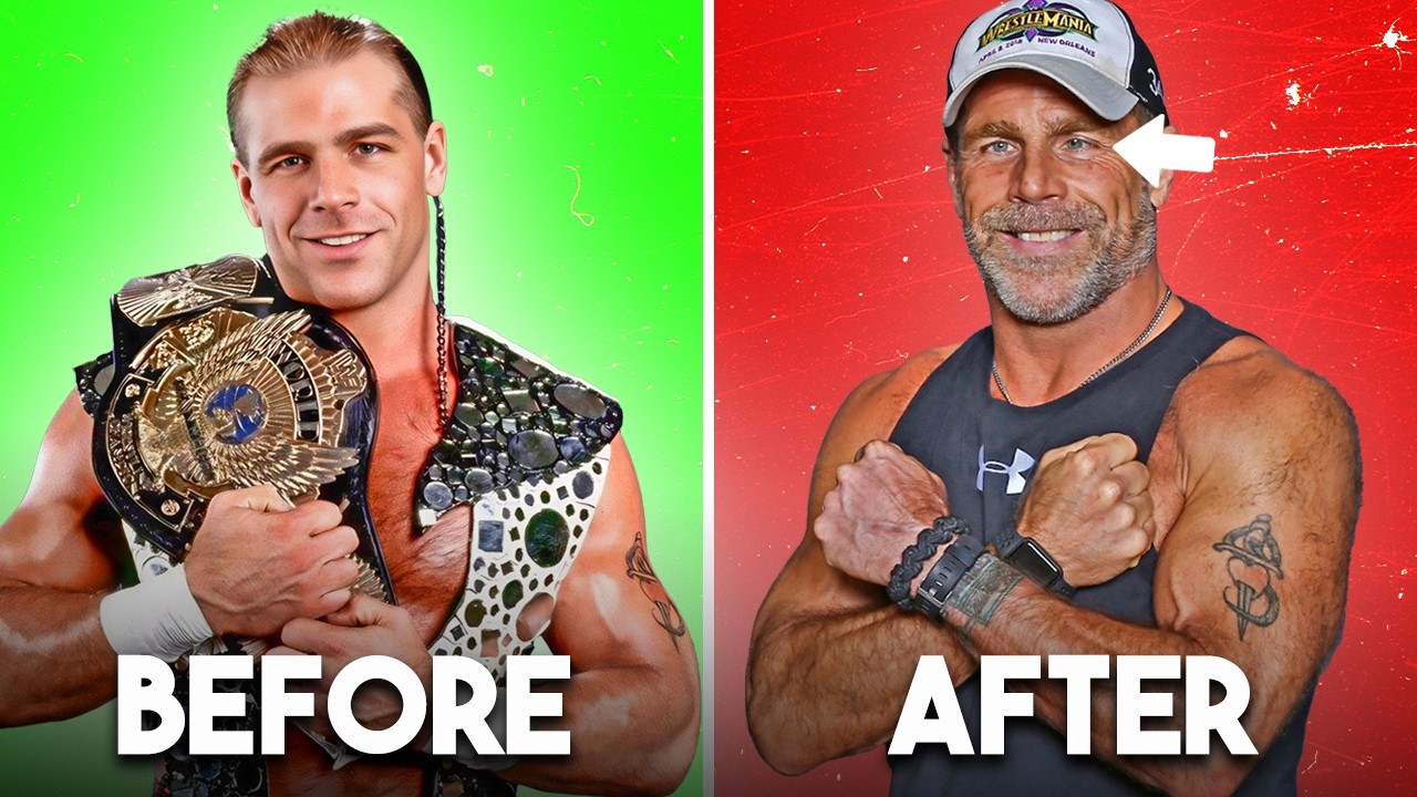 Injuries That Permanently Changed A WWE Wrestler’s Body Forever