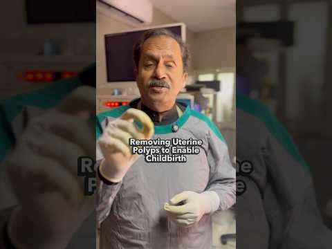 Removing Uterine Polyps to Enable Childbirth