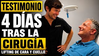 TESTIMONIO 4 DÍAS TRAS CIRUGÍA  Lifting de cara y cuello... (ANTES-DESPUÉS) Cómo tendrá la cara?