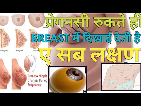 स्तनों मे ऐ 5 बदलाव हो रहे हैं तो आप प्रेगनट हो चुके हैं।Breast tenderness during early Pregnancy