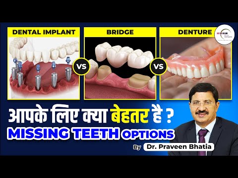 Dental Implant vs Bridge vs Denture: आपके लिए क्या बेहतर है? | Missing Teeth Options l Dr. Praveen