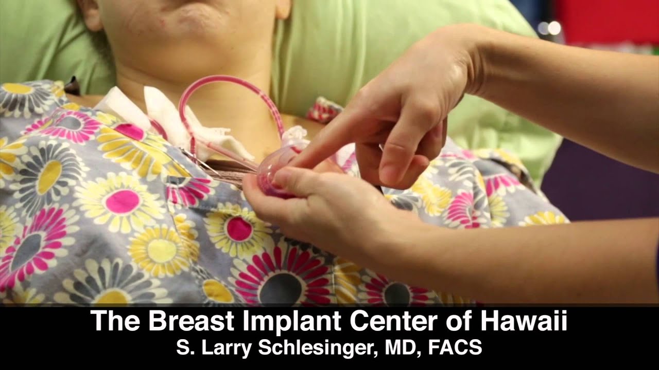 Jessica's Breast Augmentation Post Op Instructions from Dr. Schlesinger - Hawaii - Breast Implant Center of Hawaii