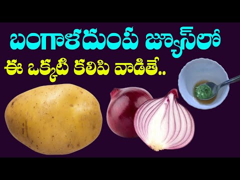 Potato Hair Mask: బంగాళదుంప జ్యూస్‌లో ఈ ఒక్కటి కలిపి వాడితే.. పొడవాటి జుట్టు ఖాయం