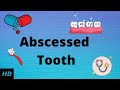 Tooth Abscess Awareness and Treatment