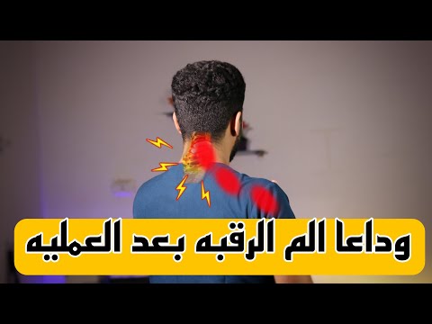 السبب الرئيسي لالم الرقبه بعد عملية الانزلاق الغضروفي العنقى وطريقة علاجه |الم الرقبه بعد العمليه