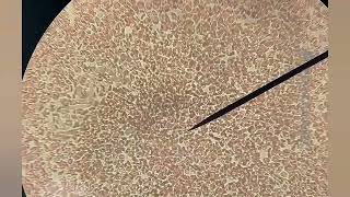 Microfilarias