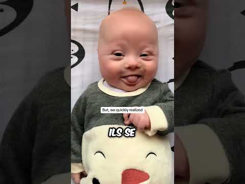 Ce bébé Down est une bénédiction ❤️