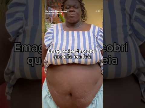 -50 kilos me sinto outra pessoa, me segue p/ acompanhar meu processo @beautyness_club 🏷️Lilian6