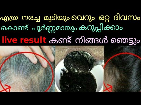 വെറും ഒറ്റ ദിവസം കൊണ്ട് നരച്ച മുടി പൂർണ്ണമായും കറുപ്പിക്കാം|live result| Hair dye Malayalam#haircare