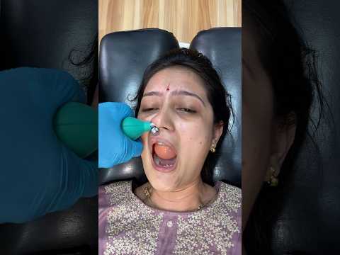 CFR #shortsfeed #chiropractic #drmahale #shorts #trending