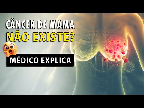 A MENTIRA sobre o CÂNCER de MAMA │ Médico Explica