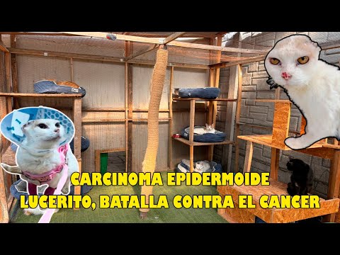 Carcinoma epidermoide, Lucerito batalla contra el cáncer