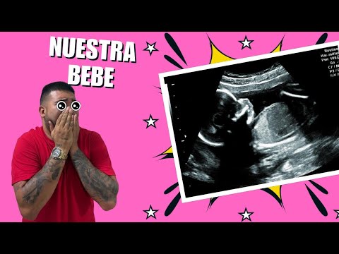 ASÍ SE VE LA CARITA DE NUESTRA BEBÉ 👶🏻 *Nuestro control Prenatal*