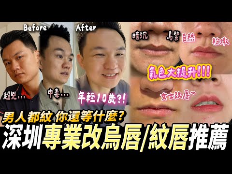 【深圳紋眉&紋唇👄】帶40歲哥哥改唇色🤭男人變年輕，女人半永久唇膏💄#深圳紋眉 #深圳紋唇 #深圳灣口岸 #深圳好去處 #南油站 #南山區 #木夕美學