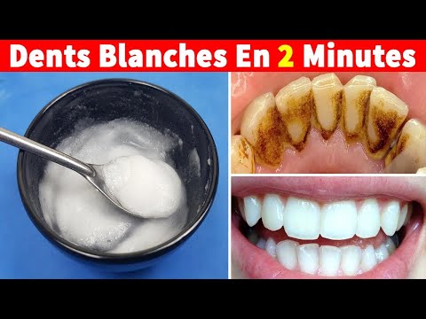 Appliquer Ceci Pendant 2 Minutes - Enlever La Plaque Et Le Tartre Des Dents Rapidement