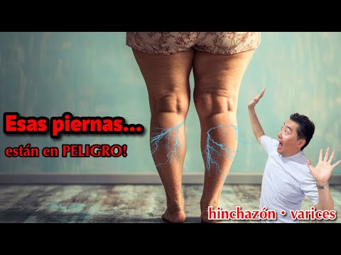 Hinchazón, pesadez, piernas gordas...tu cuerpo está lleno de toxinas, activa el drenaje linfático ya