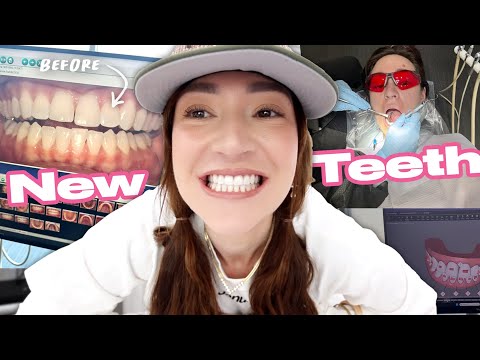 Finally Showing You My New Teeth!!!