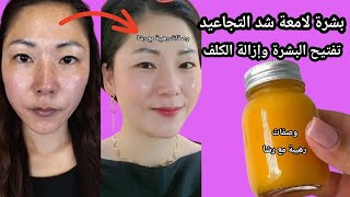 بوتوكس طبيعي وفيلر‼️شد وتفتيح ونضارة وتلميع البشرة‼️من أول مرة علاج المسام الواسعة والتجاعيد❤️