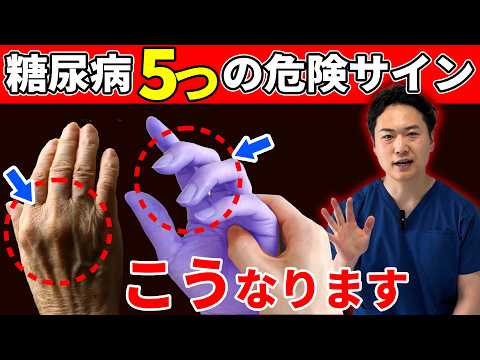 【放置厳禁】知らないと 後悔する糖尿病の初期症状｜5つの手のSOSサインと血糖値を下げる秘密のケア