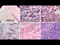 Connective Tissue Identification and Characteristics