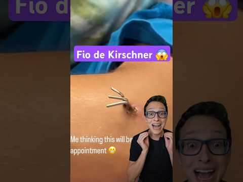 O que tem Dentro do Gesso?  😱 #medicina #medico #enfermagem #enfermeira #enfermeiro Fio de Kirschner