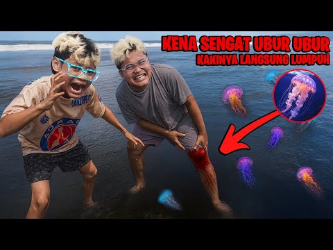 PANIK!!! YUTA DIGIGIT UBUR - UBUR BERACUN KETIKA BERMAIN DI PANTAI