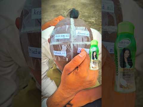 Hair growth result after 25 days