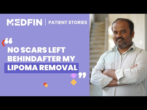 Saying Goodbye to Unwanted Lumps | Lipoma Removal | Patient talks