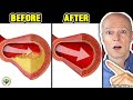 Only A Glass Of This Juice... Reverse Clogged Arteries & Lower High Blood Pressure - Doctor Reacts