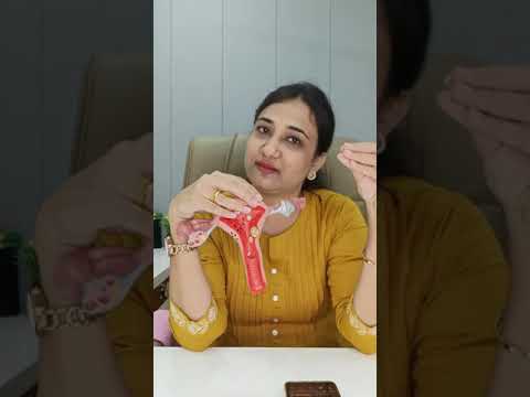 Dr.Priyanka Yadav Live | How to conceive pregnancy fast ?