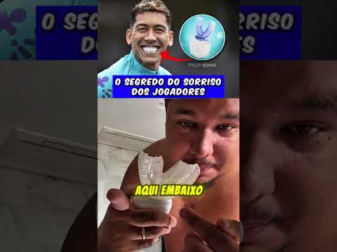 O segredo do sorriso dos jogadores #lucastylty #tyltycomp #sorriso #dente #escovaeletrica